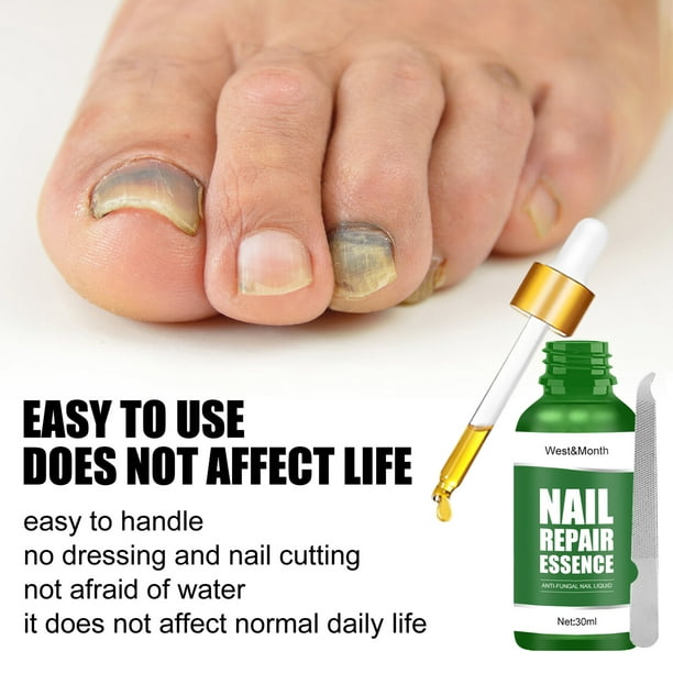 Vea Nails Aceite para reforzar las uñas