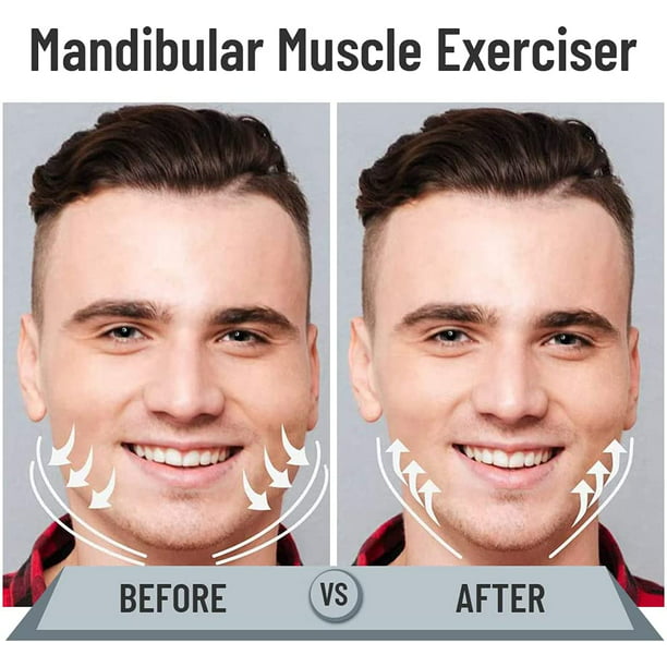 Entrenador Mandíbula Muscular Facial Para Facial Y Cuello