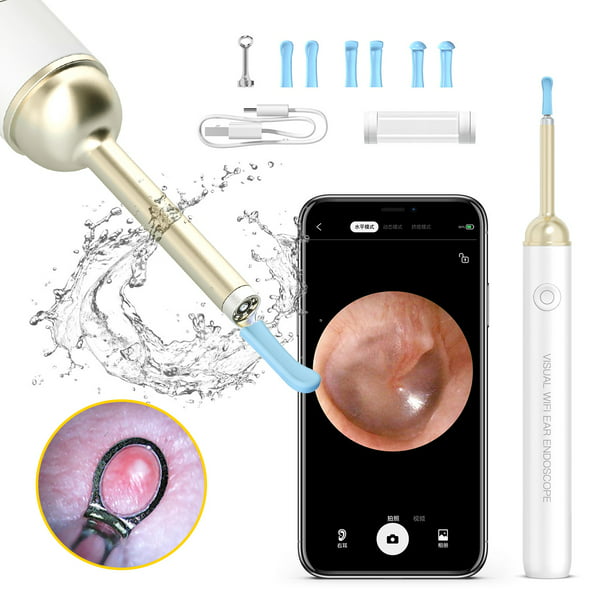 Herramienta de eliminación de cera de oídos: limpiador de oídos con cámara,  otoscopio con kit de eliminación de cera de oídos ligero con 6 púas de oído,  para iPhone, iPad, teléfonos Android