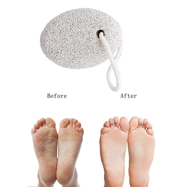Beter – Piedra pómez natural para pies, elimina durezas ligeras y pieles  muertas de los pies y de las manos, color gris : : Salud y cuidado  personal