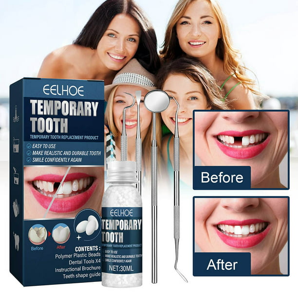 Kit de reparación de dientes temporales, gránulos moldeables para reparar dientes  postizos, perlas dentales temporales con 4 herramientas dentales, sonrisa  segura e instantánea