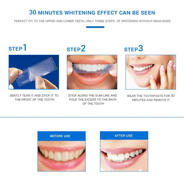 4 pares de carillas a presión en los dientes dientes de ajuste cómodo para  blanquear dentaduras postizas con mujer y hombre fiesta en sonrisa