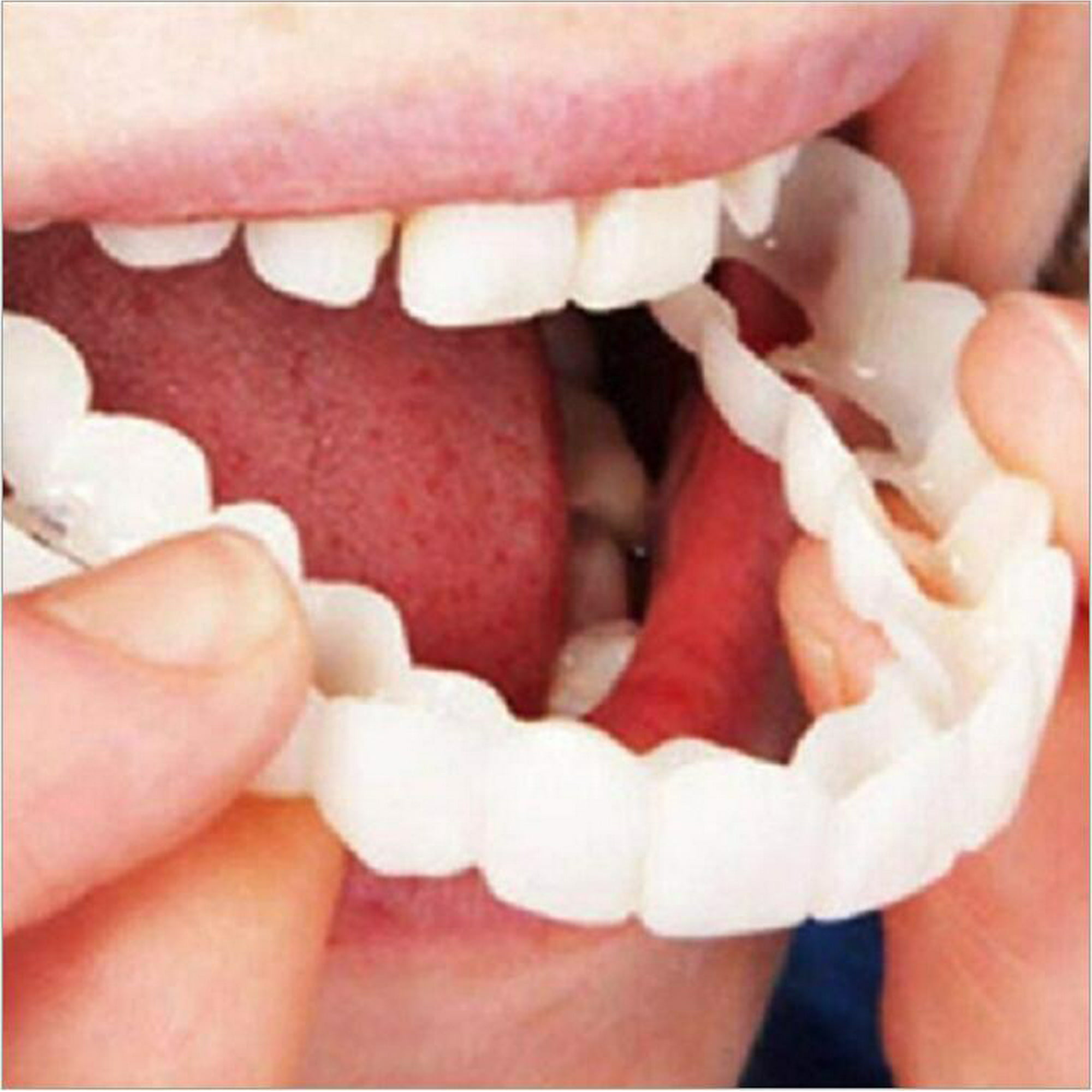 Dientes postizos Superior + Inferior Carillas dentales Dentaduras
