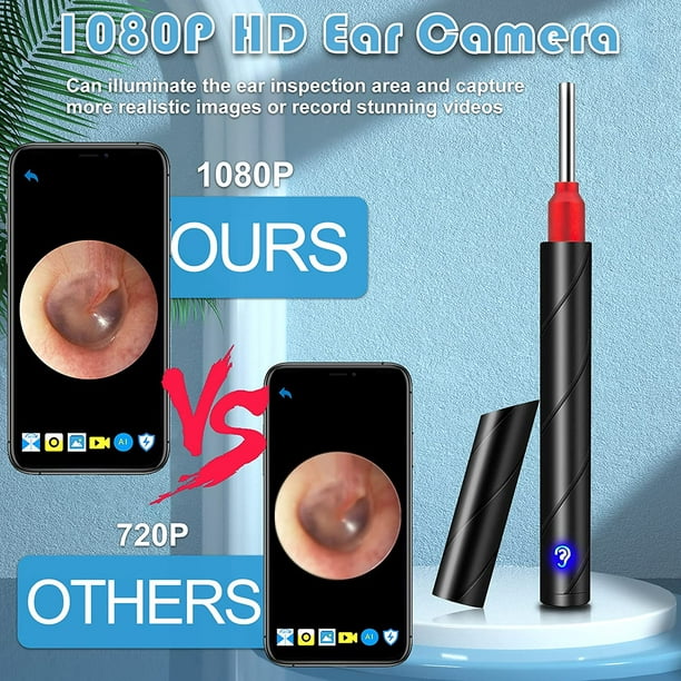 Eliminación de cera de oídos, limpiador de oídos con cámara 1080P HD  inalámbrico, otoscopio de oído con 6 luces LED, kit de eliminación de cera  de