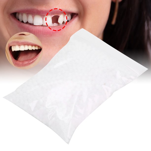 Dientes falsos, 2 piezas de carillas dentales para mujeres y hombres,  carillas para reparación temporal de dientes superior e inferior de la