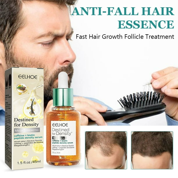 Aceite de unión para el cuidado del cabello de 30 ml, aceite nutritivo para  todo tipo de cabello, antipérdida de cabello Tmvgtek Cuidado Belleza
