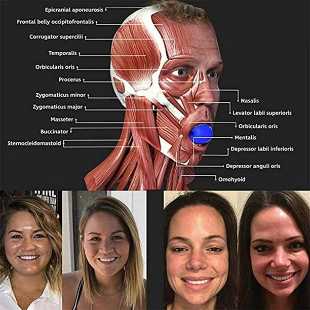 Azul - entrenador de mandíbula masticador de músculos de mordida facial  Xemadio LN-2084-2