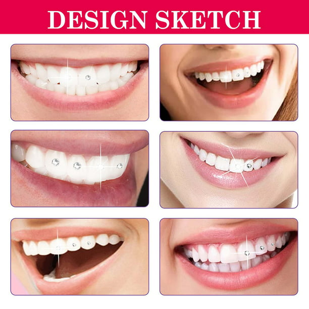  Kit de gema dental – Kit profesional de gemas dentales – Juego  de paquete con kit de pegamento, retractor de mejillas, rollo de algodón  dental – Microcepillo – Joyería de dientes –