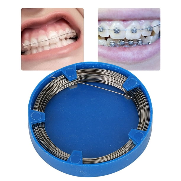 Función del Alambre Trenzado en Ortodoncia - Clínica Dental Everest