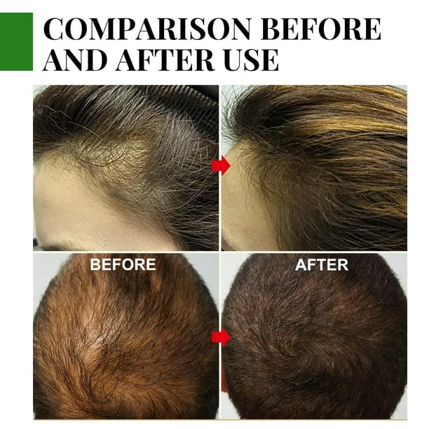 Opción LOW COST del aceite de romero de TikTok para hacer crecer tu pelo