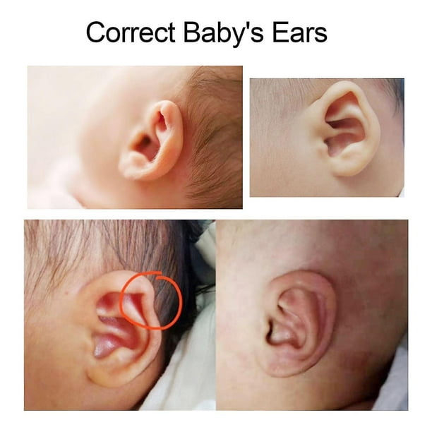 Corrector estético de oreja de bebé, corrección de orejas sobresalientes  para bebés, 4X50cm, correctores estéticos de oreja de silicona para niños,  pegatina de parche