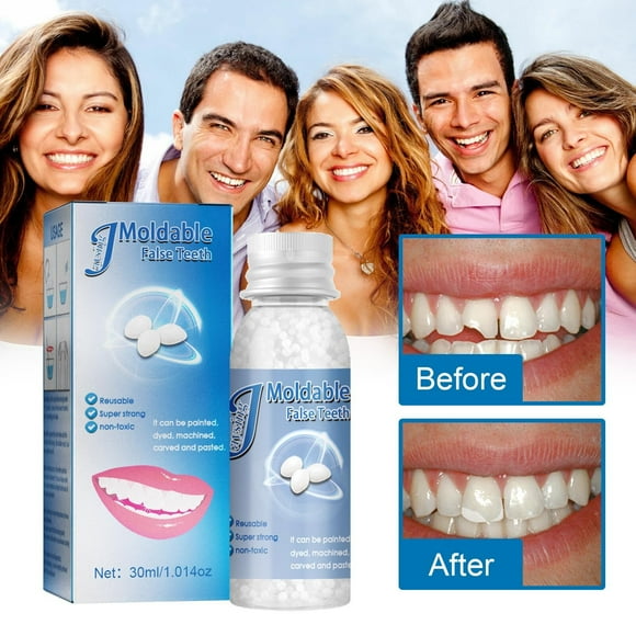 kit de restauración dental temporal relleno con perlas calientes para reparar dientes perdidos o rotos o dentaduras postizas adhesivas 30 ml jm jm