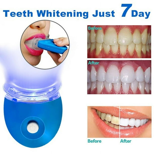 1 juego de carillas dentales dentales, kits de cuidado dental para dientes  cosméticos de ortodoncia antimolar, dientes a presión de sonrisa (blanco, 1