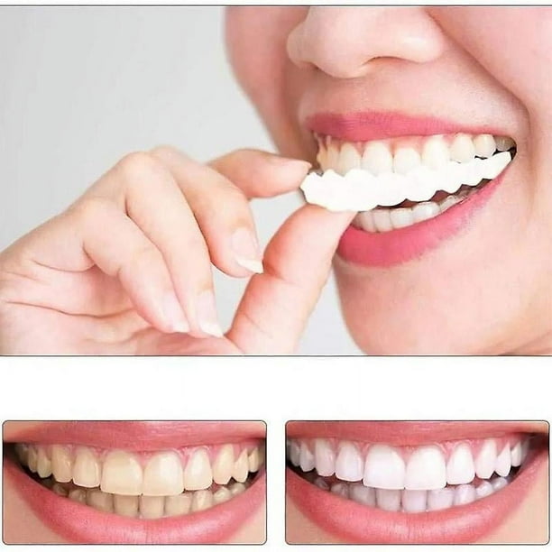 Dientes postizos de chapa de silicona, carillas superiores e inferiores,  dientes falsos temporales, dientes cosméticos, cubierta de dientes falsos,  1