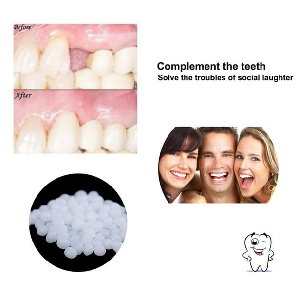 Pegamento Dental de 10/100g pegamento sólido práctico para dentadura postiza  herramienta de belleza de dientes para adultos Unisex