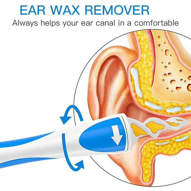 Limpiador de oídos en espiral mejorado con mango y 16 puntas lavables, Kit  de limpieza de oídos para adultos, 16 Uds.