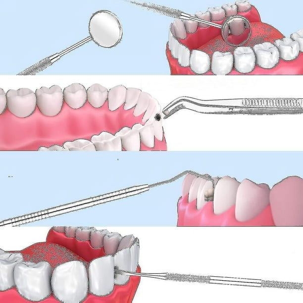 Espejo dental de acero inoxidable 1 pieza Dentista Odontología Bucal  Instrumentos Herramientas Blanqueamiento dental