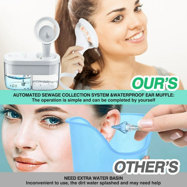 Limpiador de oídos eléctrico para adultos y niños, sistema de riego de  eliminación de cera de oído, arandela de oreja de seguridad, Kit de limpieza  de oídos