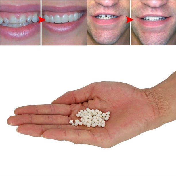 Pegamento Sólido para Dentaduras Postizas, Solución Temporal para el  Relleno de Huecos en los Dientes de Advancent CE002575-00