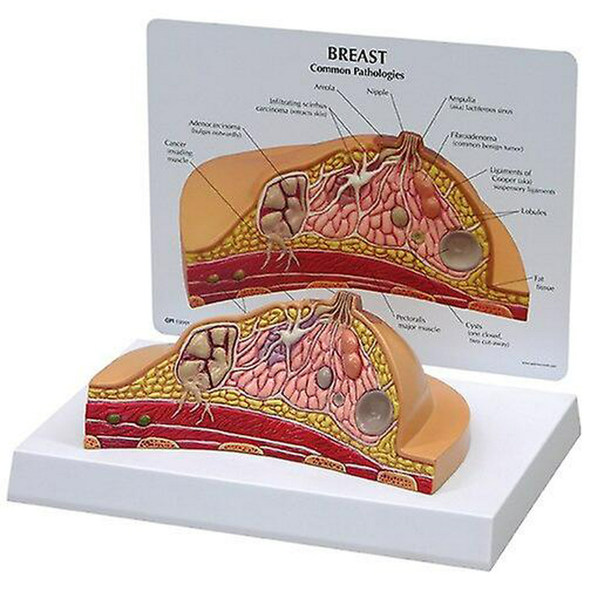 Enfermedad De Los Senos Modelo De Anatomía Del Seno Modelo De Cuerpo Humano Anatómico Modelo De 2135