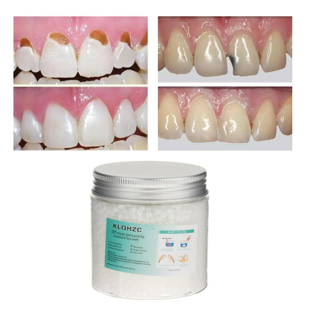 Pegamento de resina para reparar dentaduras postizas, adhesivo de seguridad  para relleno