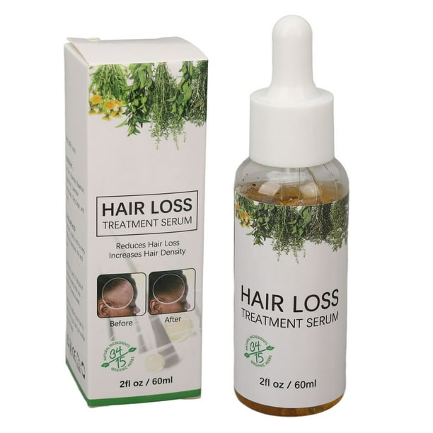 Comprar 60ML de aceite de romero para el crecimiento del cabello