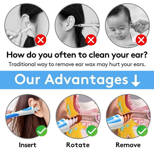 Cómo limpiar los oídos de un bebé para quitar la cera de forma segura
