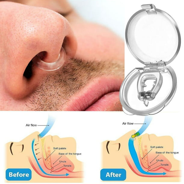 YES - Clip de nariz antironquidos para respiración, solución eficaz para  detener los ronquidos para hombres y mujeres, tapón para dormir mejor, 3