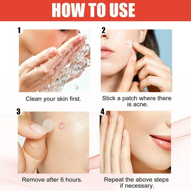 144 parches transparentes para granos de acné, 2 tamaños para desvanecer las Yuyangstore Parches para espinillas de acné | Bodega en línea