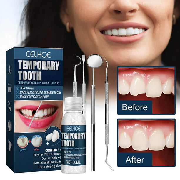 Kit De Reparación De Relleno Dental Temporal, Dientes Postizos, Pegamento  Sólido, Cuentas De Reparación Dental Para Falta De Dientes Rotos Para  Mujeres Y Hombres De 11,15 €