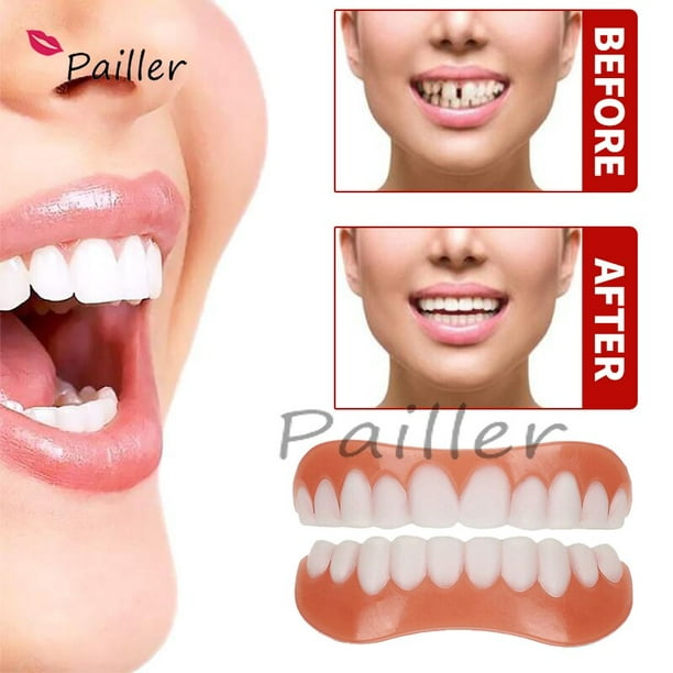 Carillas dentales temporales de silicona, dientes cosméticos de comodidad  superior, abrazaderas a presión de sonrisa instantánea para dientes  agrietados, manchados y faltantes YONGSHENG YONGSHENG