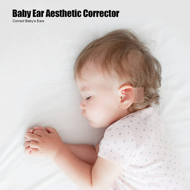 Corrector estético de orejas de bebé Corrección de orejas