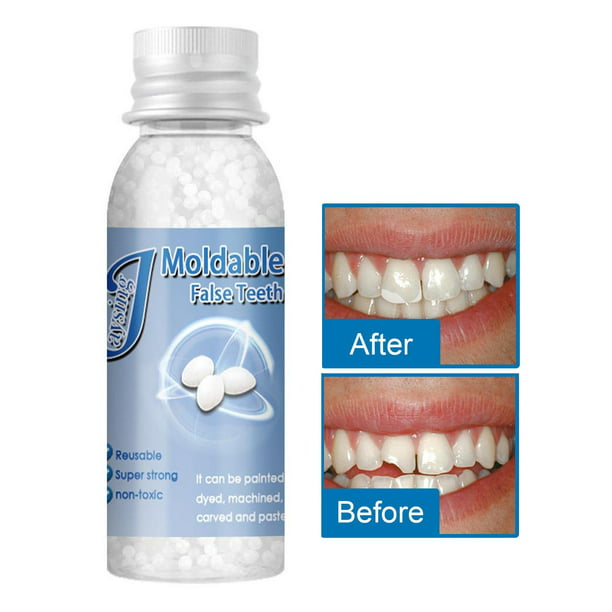 Comprar Kit de reparación temporal de dientes, dentadura postiza, pegamento  sólido para dentadura postiza, dientes rotos faltantes, moldeable, 1 ud.
