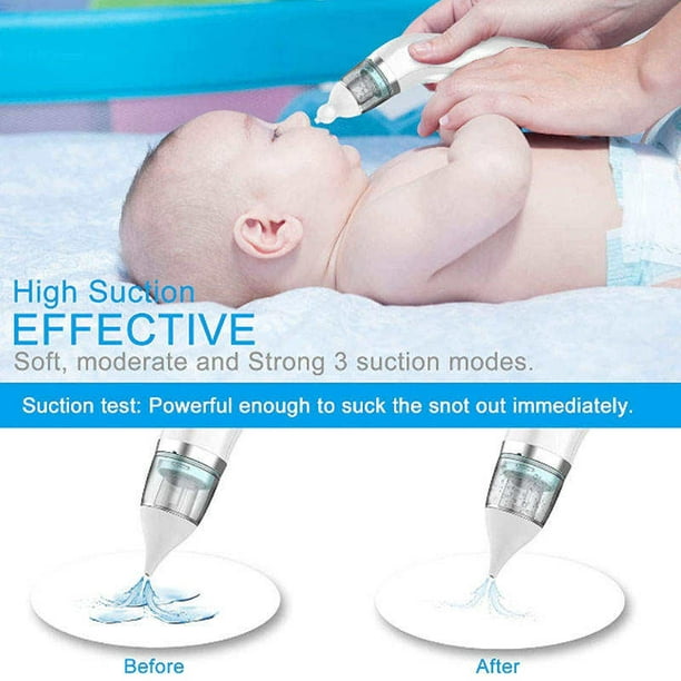 Aspirador nasal para bebé, ventosa nasal para bebé, limpiador de nariz para  bebé, aspirador nasal eléctrico para niños pequeños, recargable con