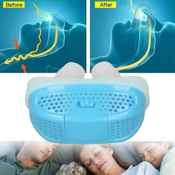 Dispositivo Eléctrico para Prevenir Ronquidos, Solución Antironquidos de  Fuerza para Hombres, Mujeres (Azul)
