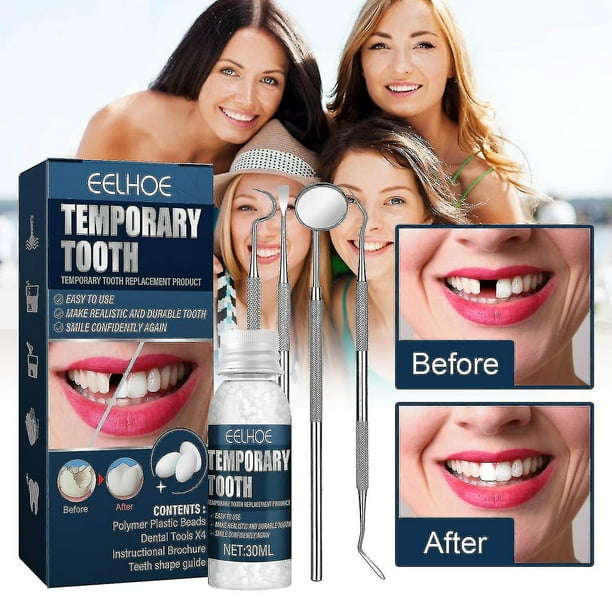 Kit de reparación temporal de dentadura postiza, relleno de dientes  moldeable, pegamento sólido para dentadura postiza (hy) YONGSHENG  8390605342554