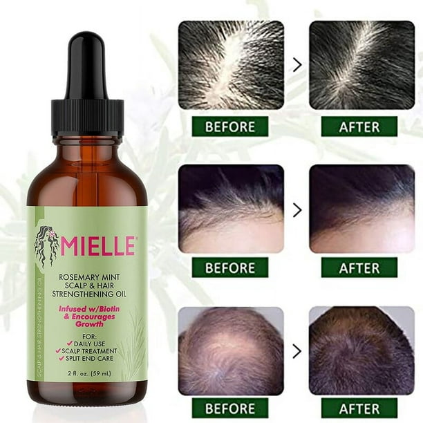  Mielle - Productos para el cabello de menta y romero para un  cabello más fuerte y saludable, paquete de 5 unidades : Belleza y Cuidado  Personal